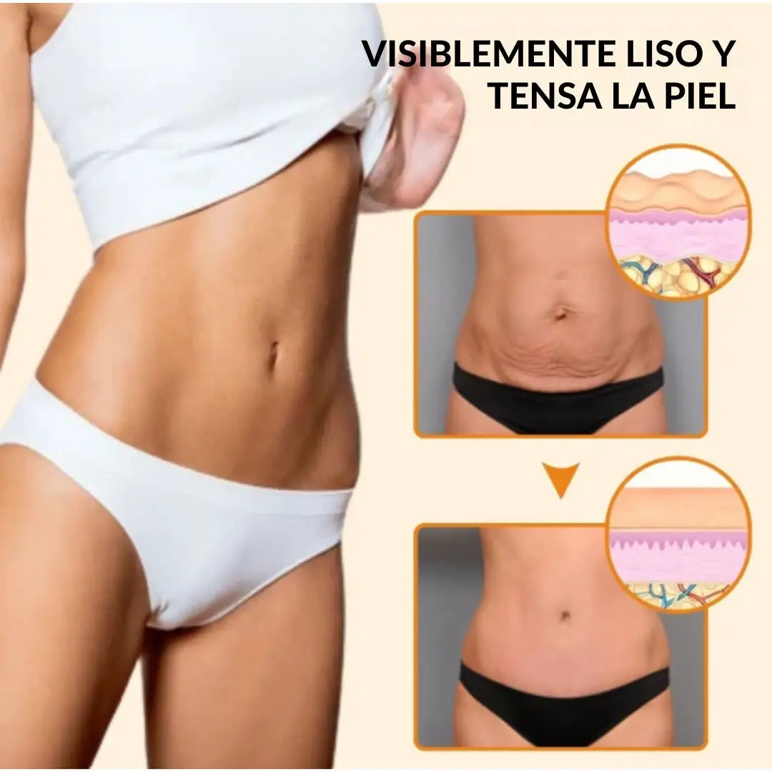 2X1 Nueva Formula Mejorada Antiestrías Skinrepair