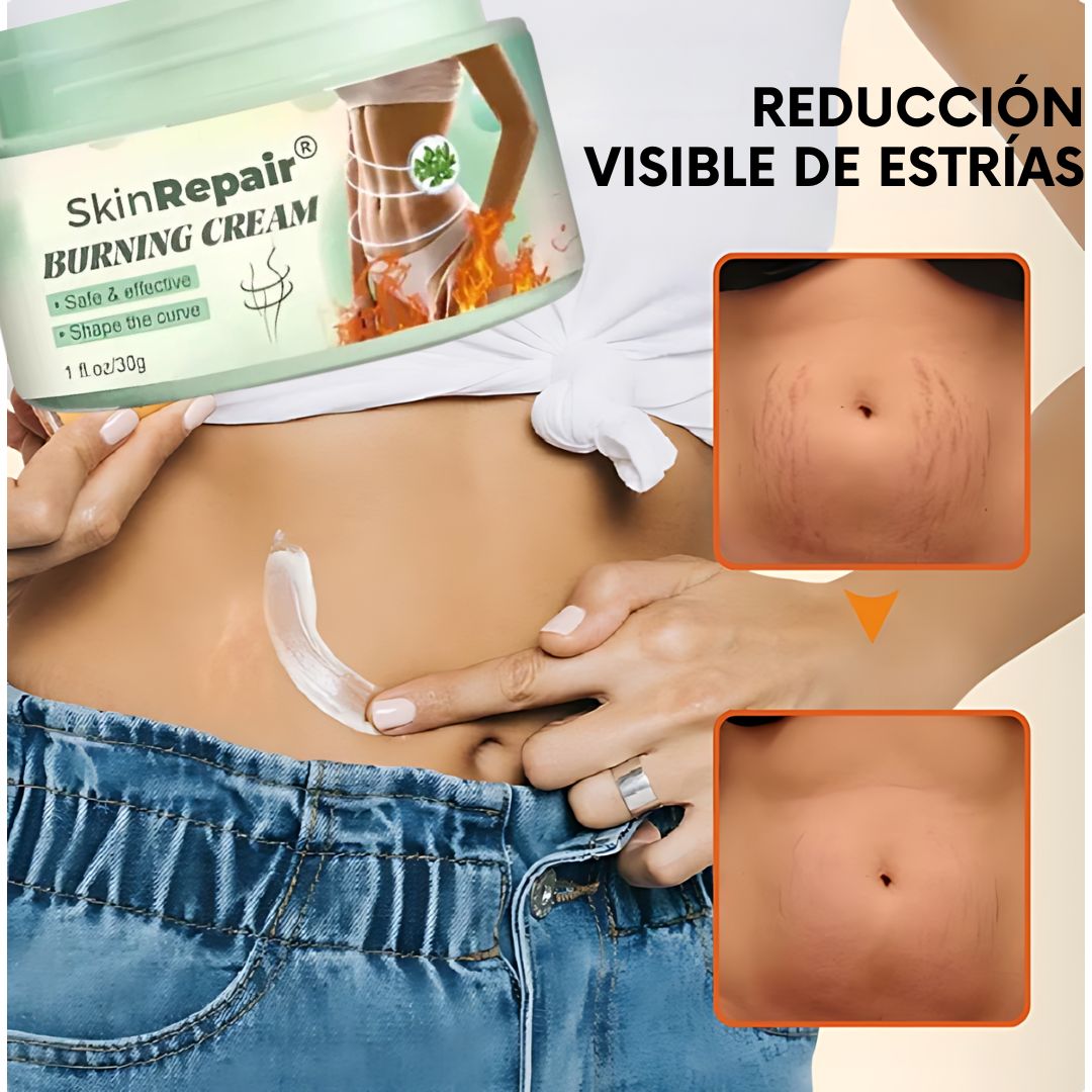 2X1 Nueva Formula Mejorada Antiestrías Skinrepair
